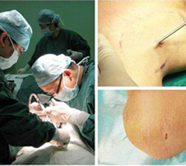 專家詳解：皮膚病有哪些癥狀與危害